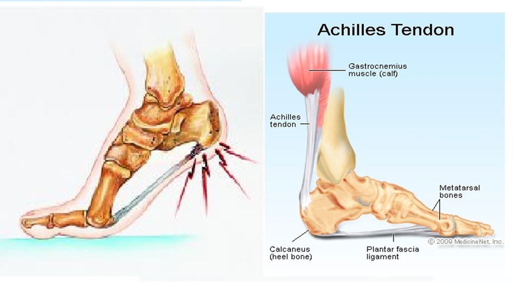 heel bone